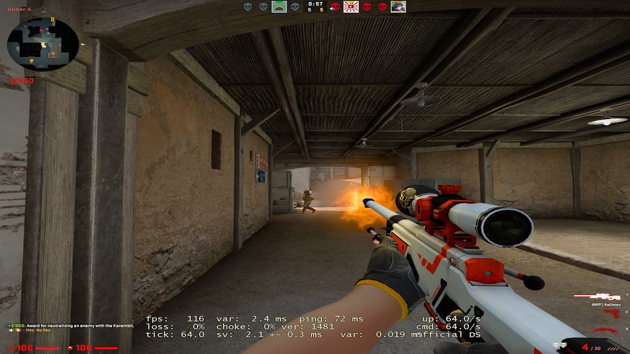 "noscope or your a looser"